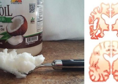 Uleiul de cocos – combustibil pentru creier ?