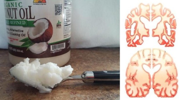Uleiul de cocos – combustibil pentru creier ?